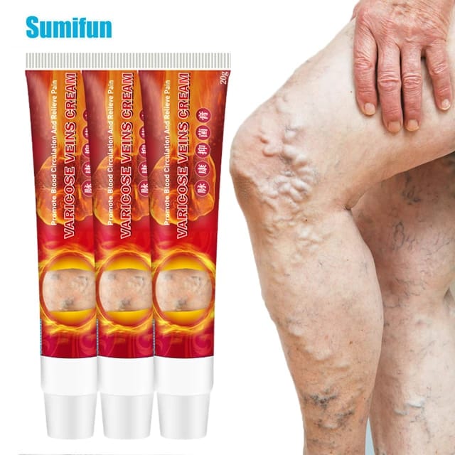 Pomada para varices