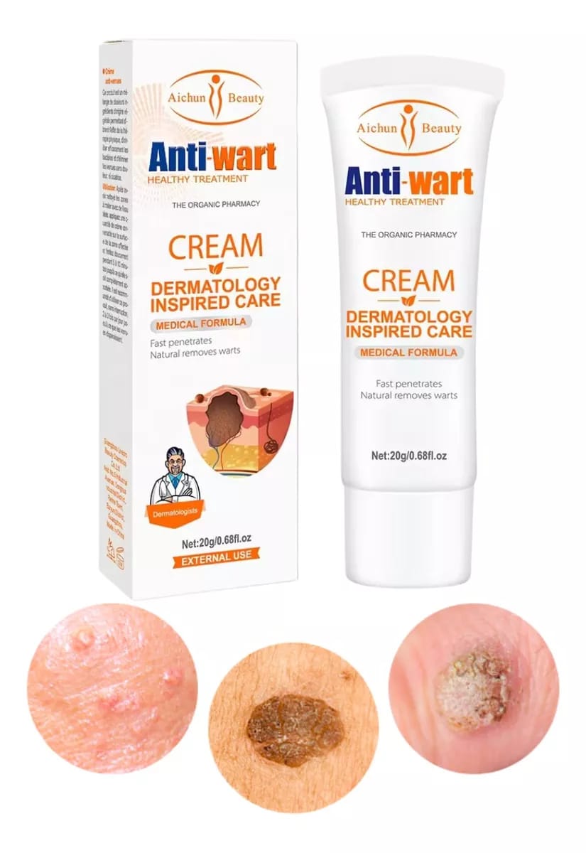 Crema elimina verrugas