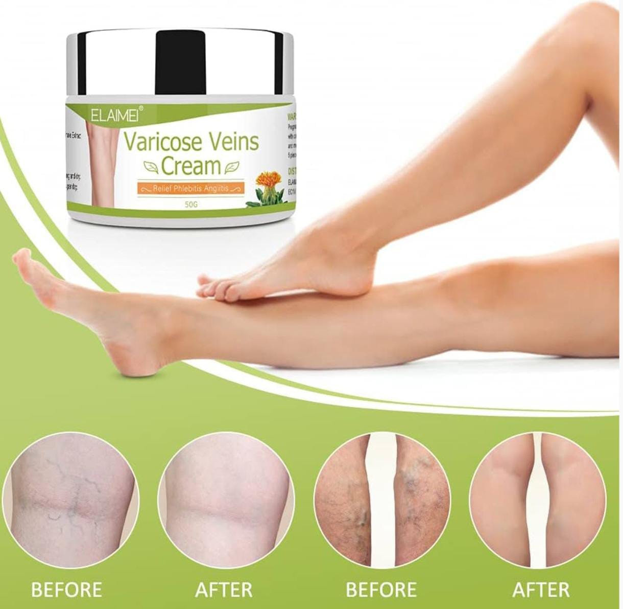 CREMA PARA VÁRICES VIRAL