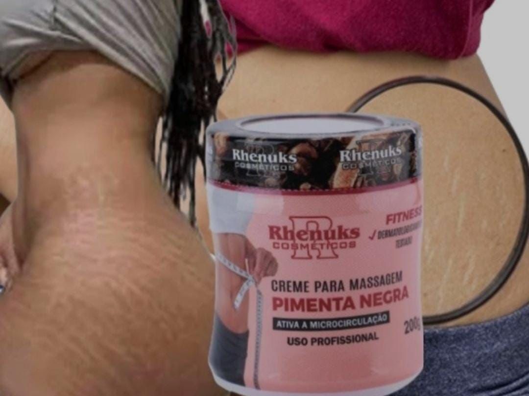 CREMA PARA ESTRIAS