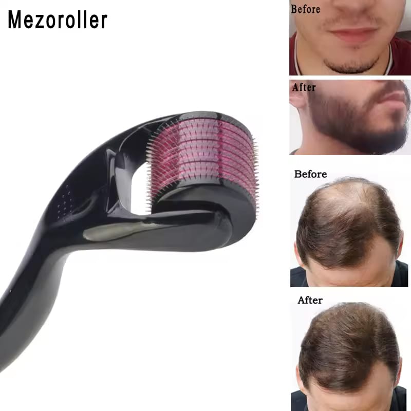 DERMA ROLLER